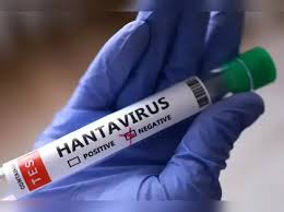 Hantavirus